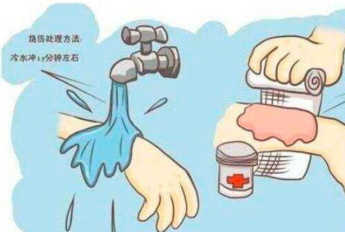 预防宝宝被烫伤家长应该注意3件事情